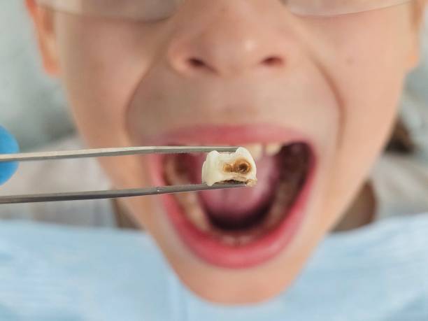 Best Emergency Pediatric Dentist  in Auburn, IN